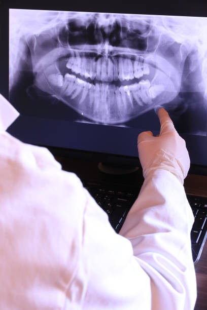 Best Emergency Treatment for Dental Infections or Abscesses in Powers Lake, WI