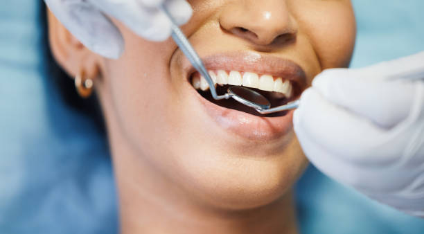 Best Emergency Root Canal Treatment in Powers Lake, WI