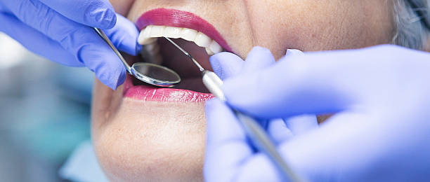 Best Emergency Root Canal Treatment in Powers Lake, WI